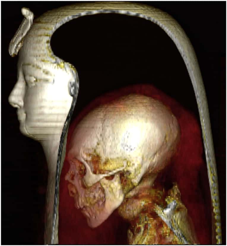 Three-dimensional CT image of the head of the wrapped mummy of Amenhotep I in a left lateral view allows visualization of the component layers: the mask, the head of the mummy, and the surrounding bandages.