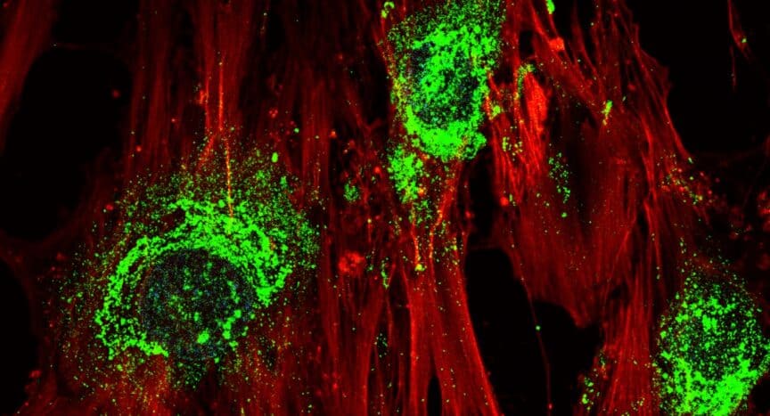 A magnified image showing adult stem cells in the process of turning into bone cells after treatment with high-frequency sound waves. Green colouring shows the presence of collagen, which the cells produce as they become bone cells. Magnification: 60X