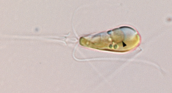 A light microscopy image shows the marine haptophyte algae Braarudosphaera bigelowii with a black arrow pointing to the nitroplast organelle. (Photo credit: Tyler Coale)